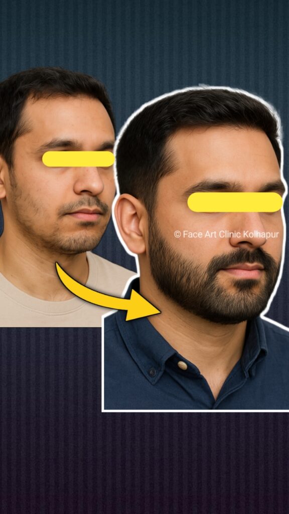 Best Beard Growth Treatments